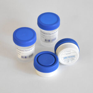 Frasco de Orina y Coprológico