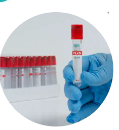 TUBO TAPA ROJO SIN ADITIVO 6ML